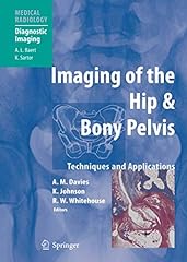 Imaging hip bony for sale  Delivered anywhere in USA 