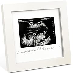 Baby sonogram picture for sale  Delivered anywhere in USA 