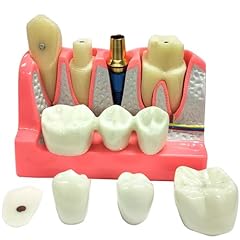 Times dental implant for sale  Delivered anywhere in USA 