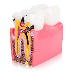 Modèle anatomie dentaire d'occasion  Livré partout en France