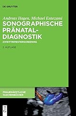 Sonographische pränataldiagno gebraucht kaufen  Wird an jeden Ort in Deutschland