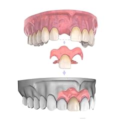 Custom partial dentures for sale  Delivered anywhere in USA 