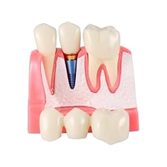 Dental model times for sale  Delivered anywhere in USA 