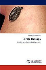 Leech therapy blood for sale  Delivered anywhere in UK