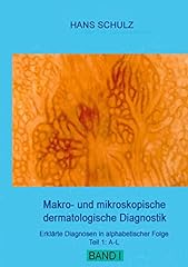 Makro mikroskopische dermatolo gebraucht kaufen  Wird an jeden Ort in Deutschland