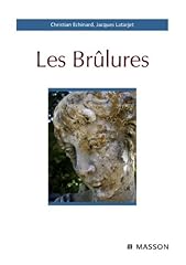 Les brûlures (Hors collection) (French Edition) for sale  Delivered anywhere in Canada