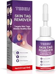 Wart remover wart for sale  Delivered anywhere in UK