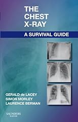 The Chest X-Ray: A Survival Guide for sale  Delivered anywhere in Canada