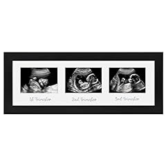Americanflat sonogram picture for sale  Delivered anywhere in USA 