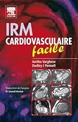 Irm cardiovasculaire facile d'occasion  Livré partout en Belgiqu