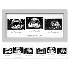 Sonogram picture frame for sale  Delivered anywhere in USA 