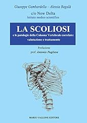 Scoliosi patologie della usato  Spedito ovunque in Italia 