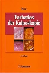 Farbatlas kolposkopie gebraucht kaufen  Wird an jeden Ort in Deutschland