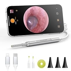 Anyscope digital otoscope for sale  Delivered anywhere in USA 