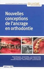 Nouvelles conceptions ancrage d'occasion  Livré partout en France