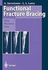 Functional fracture bracing for sale  Delivered anywhere in UK