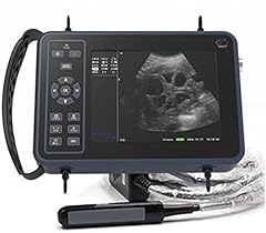 Portable ultrasound scanner for sale  Delivered anywhere in UK