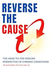 Reverse cause head for sale  Delivered anywhere in USA 