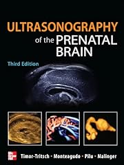 Ultrasonography the prenatal d'occasion  Livré partout en France