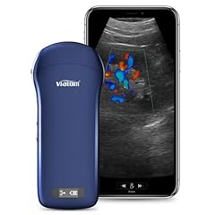 Viatom ecografo portatile usato  Spedito ovunque in Italia 