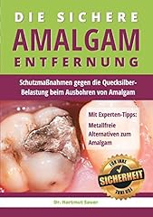 Sichere amalgam entfernung gebraucht kaufen  Wird an jeden Ort in Deutschland