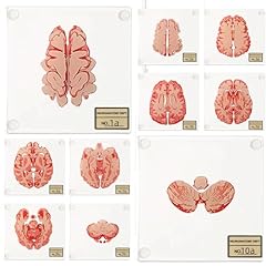 Natalieenati anatomic brain for sale  Delivered anywhere in USA 