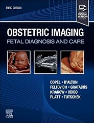 Obstetric imaging fetal for sale  Delivered anywhere in USA 