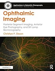 Ophthalmic imaging posterior for sale  Delivered anywhere in USA 