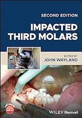 Impacted third molars for sale  Delivered anywhere in USA 