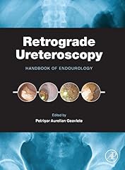 Retrograde ureteroscopy handbo for sale  Delivered anywhere in USA 