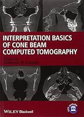 Interpretation basics cone for sale  Delivered anywhere in USA 