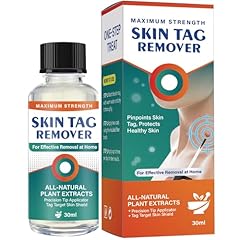 Skin tag remover for sale  Delivered anywhere in UK