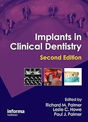 Implants clinical dentistry for sale  Delivered anywhere in USA 