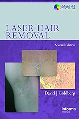 Laser hair removal gebraucht kaufen  Wird an jeden Ort in Deutschland