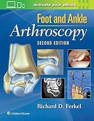 Foot ankle arthroscopy for sale  Delivered anywhere in USA 