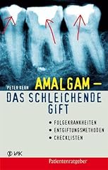 Amalgam schleichende gift gebraucht kaufen  Wird an jeden Ort in Deutschland