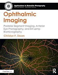 Ophthalmic imaging posterior for sale  Delivered anywhere in USA 