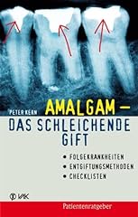 Amalgam schleichende gift gebraucht kaufen  Wird an jeden Ort in Deutschland