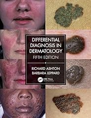 Differential diagnosis dermato for sale  Delivered anywhere in UK