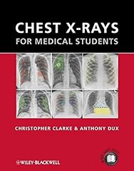 Chest rays for d'occasion  Livré partout en France