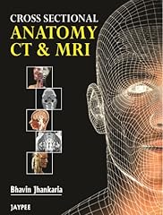 Cross sectional anatomy for sale  Delivered anywhere in USA 