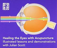 Healing eyes acupuncture for sale  Delivered anywhere in USA 