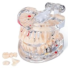 Annhua transparent tooth for sale  Delivered anywhere in USA 