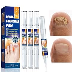 Stück nagelreparaturstift fin gebraucht kaufen  Wird an jeden Ort in Deutschland
