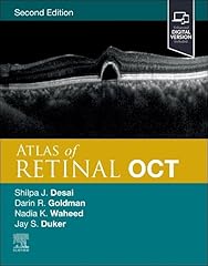 Atlas retinal oct for sale  Delivered anywhere in USA 