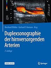 Duplexsonographie hirnversorge gebraucht kaufen  Wird an jeden Ort in Deutschland