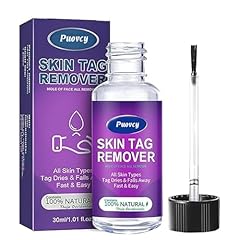 Skin tag removal for sale  Delivered anywhere in UK