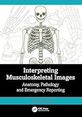 Interpreting musculoskeletal i for sale  Delivered anywhere in UK