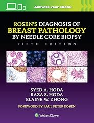 Rosen diagnosis breast for sale  Delivered anywhere in USA 