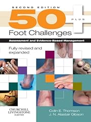 Foot challenges assessment for sale  Delivered anywhere in USA 
